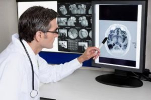 Компьютерная томография головного мозга и мрт головного мозга отличие thumbnail