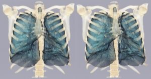 Чем отличается мрт грудного отдела от грудной клетки thumbnail