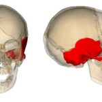 Особенности проведения КТ лицевой части черепа
