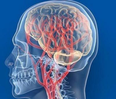 Особенности проведения КТ сосудов и мягких тканей головного мозга с использованием контраста