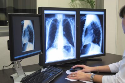 Различие между МРТ и рентгеном, особенности обследований