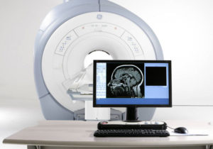 томография мозга