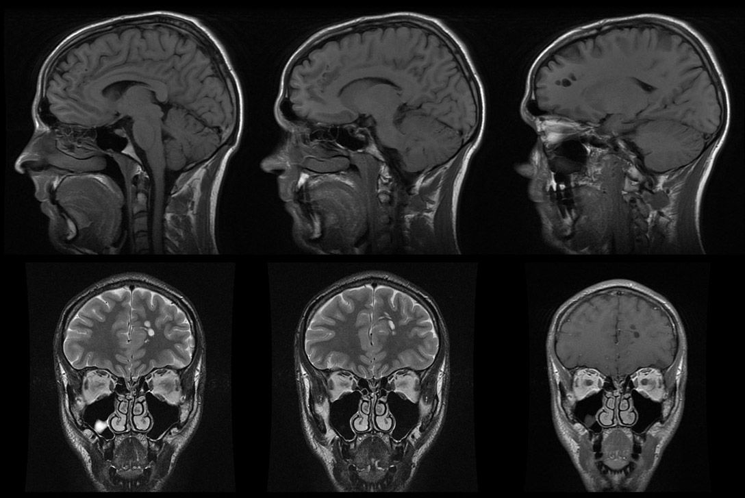 Снимок мрт. Магнитно-резонансная томография черепа. Мрт головы спереди. MRI головного мозга. Мрт скан.